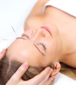 facial acupuncture